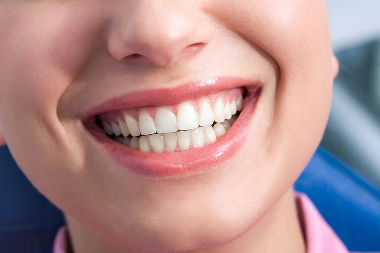 Read more about the article Crowning Glory: How Dental Crowns Improve Your Oral Health