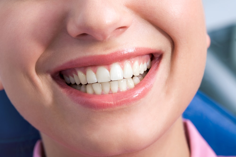 You are currently viewing Crowning Glory: How Dental Crowns Improve Your Oral Health
